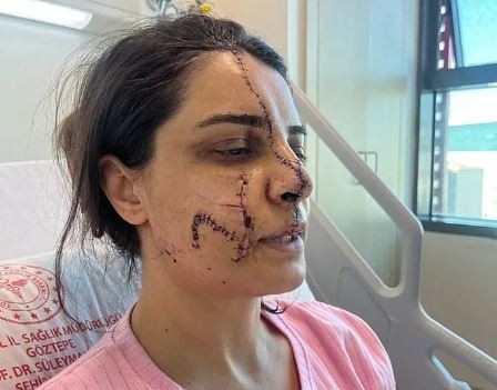 Marmaray’daki saldırganın ağaçtaki görüntüsü ortaya çıktı: Tırmanıp taciz etti!