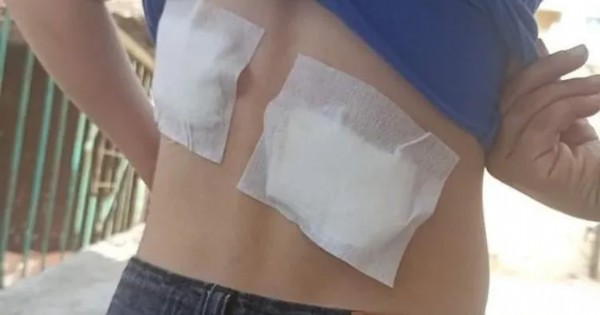 Bir köpek saldırısı daha! 8 yaşındaki Ömer'e saldırdı