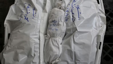 Bilanço ağırlaşıyor! Gazze'de can kaybı 34 bin 735'e yükseldi