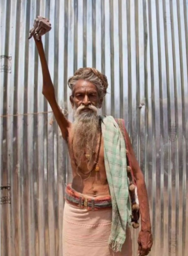 50 yıldır sağ kolu havada yaşıyor! Sebebi ise...