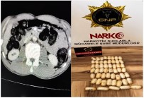 Yabanci Uyruklu Sahsin Midesinden 53 Paket Uyusturucu Çikti
