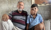Milyonda bir görülen hastalık: İki farklı yüzü var gibi görünüyor