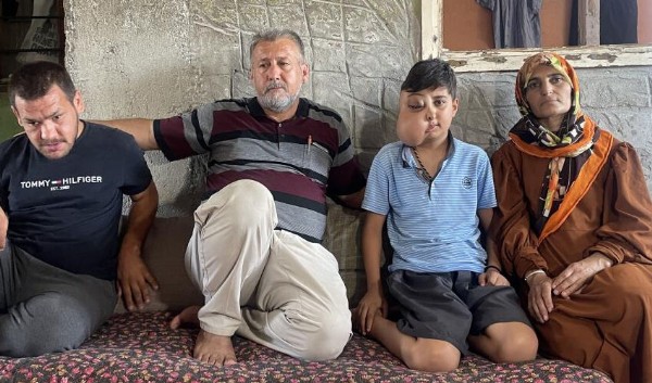 Milyonda bir görülen hastalık: İki farklı yüzü var gibi görünüyor