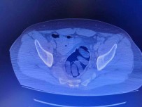 Uyusturucu Midelerinden Çikti