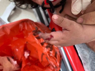 1 Yasindaki Bebek Parmagini Vantilatöre Kaptirdi, Uzmanlar Uyardi Açiklamasi '1 Ayda 4-5 Hastamiz Oldu'