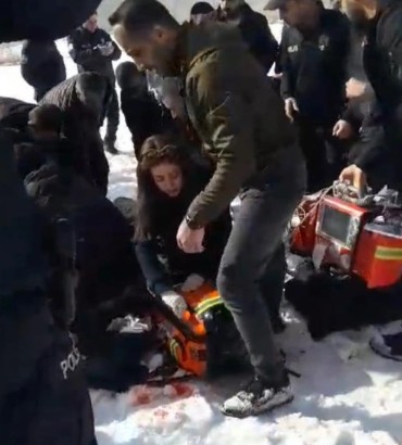 Yine başıboş köpek skandalı! 12 yaşındaki çocuğa saldırdı