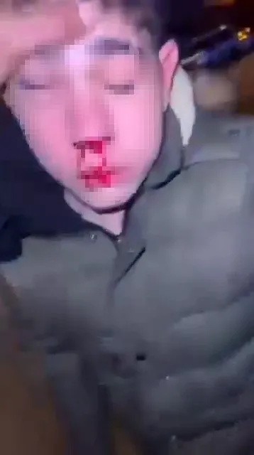 Sosyal medya bu görüntüleri konuşuyor! Sağır ve dilsiz çocuğa işkence: Sana da böyle yaparız!