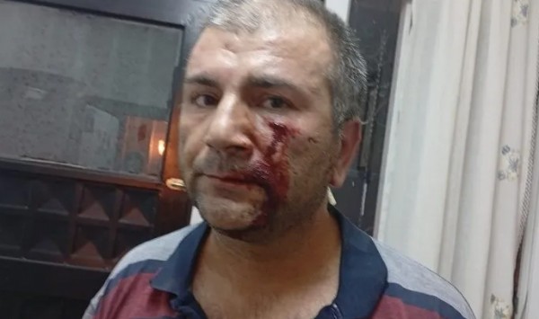 Adana’da yol isteyen adam saldırganların kurbanı oldu!