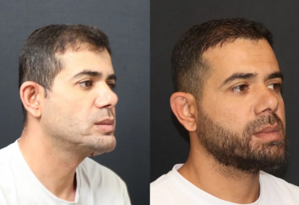 Çenesini Kaybetmişti! Operasyon Başarılı Oldu...