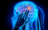 BEYİN ÇİPİ - Felçliler İçin Üretilen Beyin Çipi Çağ Açtı