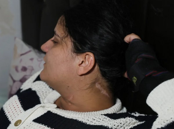 Eşi Boğazını Kesti! Engelli Kaldı!