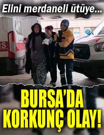Elini merdaneli ütüye sıkıştırdı! Üçüncü derece yanık meydana geldi!