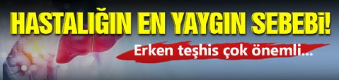 Karaciğer Hastalıklarının En Yaygın Nedeni!
