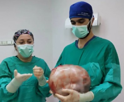 Karnından 9 Kiloluk Kitle Çıktı!