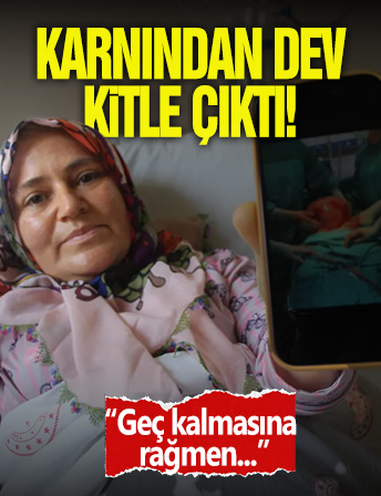 Karnından 9 Kiloluk Kitle Çıktı!