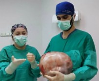 Karnından 9 Kiloluk Kitle Çıktı! Haberi