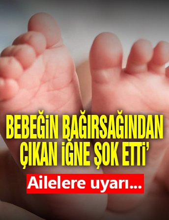 2 Yaşındaki Bebeğin Bağırsağından İğne Çıktı!