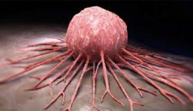 Kanser Tedavisinde Yeni Dönem!