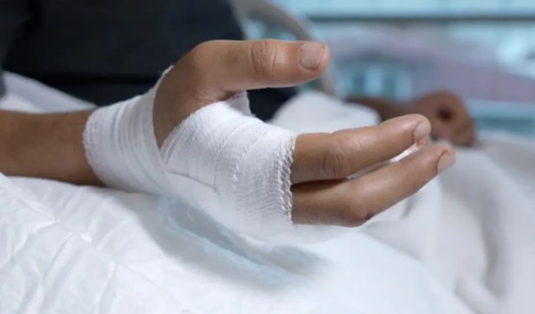 Kazada Kopan Parmak Tekrar Dikildi!