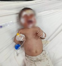 ŞANLIURFA - Şanlıurfa'da Yangın! İki Aylık Bebek Yaralandı...