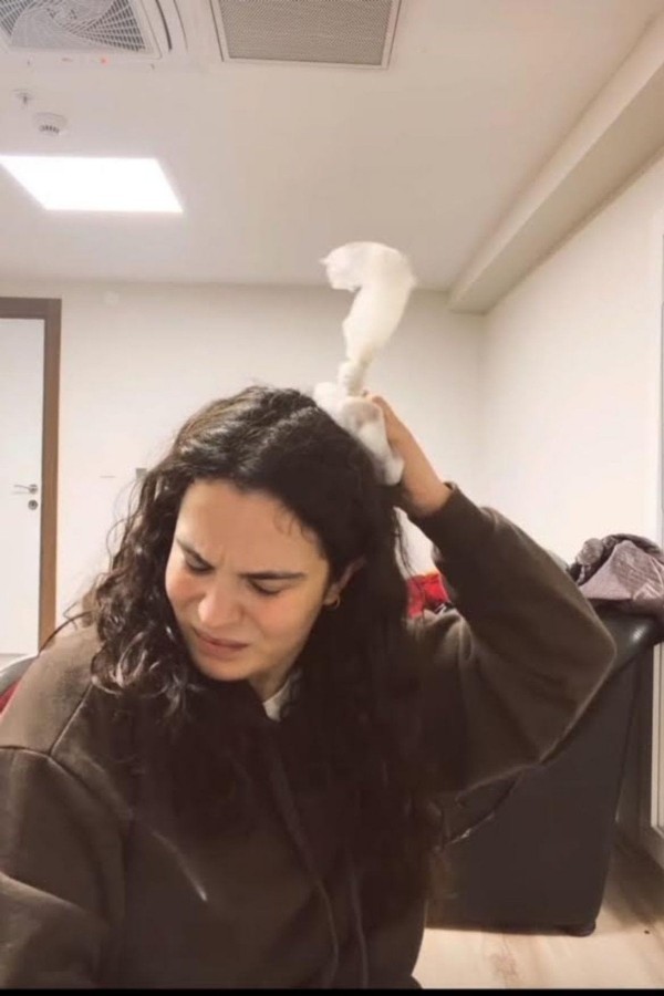 Kafasına kapı düştü