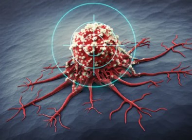 Türkiye'nin Kanser Haritası!