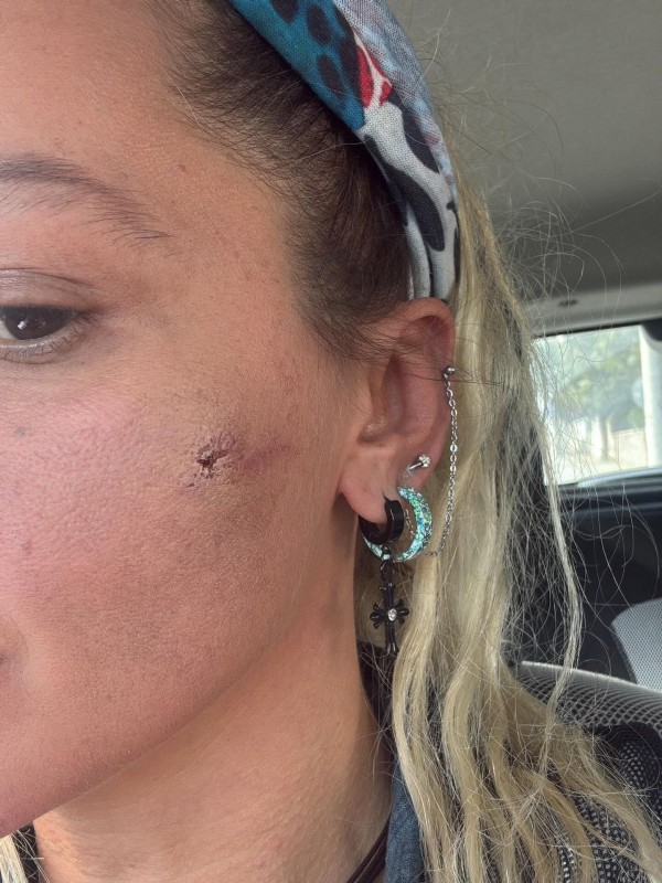 Yıldız Asyalı şiddet gördü