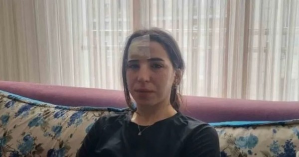 İstanbul'da başıboş köpek saldırısı! Yolda yürüyen kadına saldırdılar