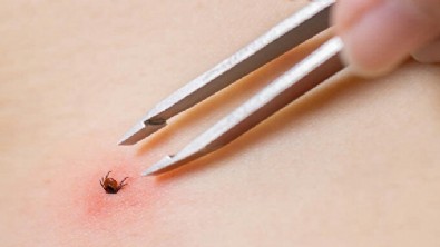 Havalar ısındı kene korkusu başladı! Bu belirtileri sakın görmezden gelmeyin