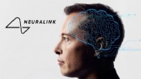 Neuralink, 3. kez insanlara uygulandı: İşte sonuçlar Haberi