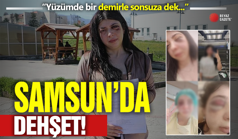 Samsun’da Damla Korkmaz sokak ortasında dehşeti yaşamıştı! “Yüzümde bir demirle sonsuza dek…”