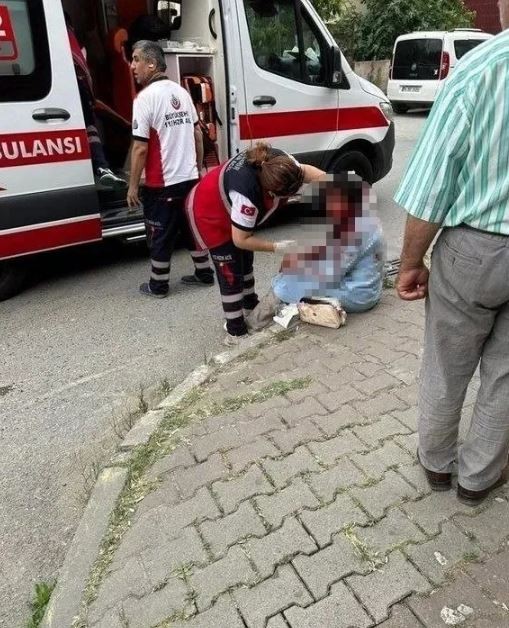 Başıboş köpek dehşeti! 'Kafamı ısırdı, gözümü kaybettim'