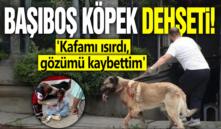 Başıboş köpek dehşeti! 'Kafamı ısırdı, gözümü kaybettim'