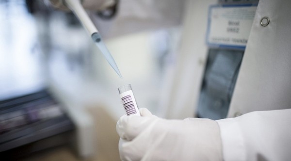 Maymun çiçeği vakalarında artış! 12 günlük kapanma ilan edildi