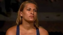 SURVİVOR - Survivor sonrası estetik yaptırdı!