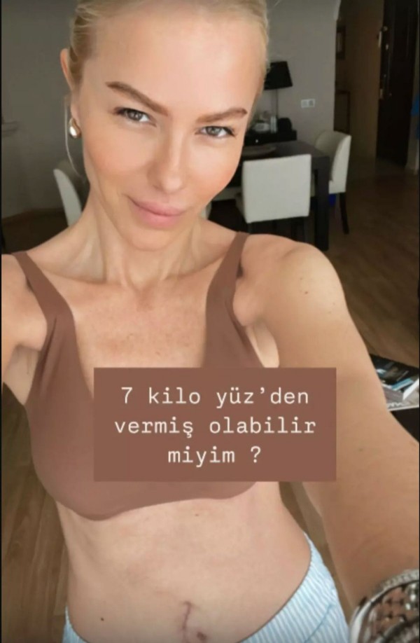 Şarkıcı Seçil Gür ameliyat oldu