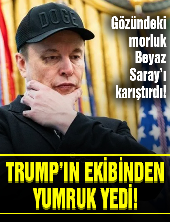 Elon Musk'ın morarmış gözünün sırrı çözüldü: Oval Ofis'te yumruk yedi
