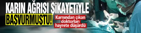 Karın ağrısı şikayetiyle başvurmuştu! Karnından çıkan doktorları hayrete düşürdü