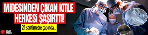 Midesinden çıkan kitle herkesi şaşırttı: 21 santimetre çapında...