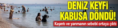 Deniz keyfi kabusa döndü! Kaşıntı ve yanmanın sebebi ortaya çıktı