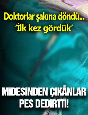 Midesinden Çıkanlar Görenleri Şaşkına Çevirdi!