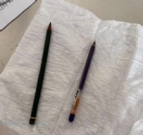  HASTA  - Midesinden Çıkanlar Görenleri Şaşkına Çevirdi!