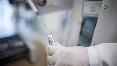 Dünyada en ölümcül bulaşıcı hastalık! Bu belirtilere dikkat