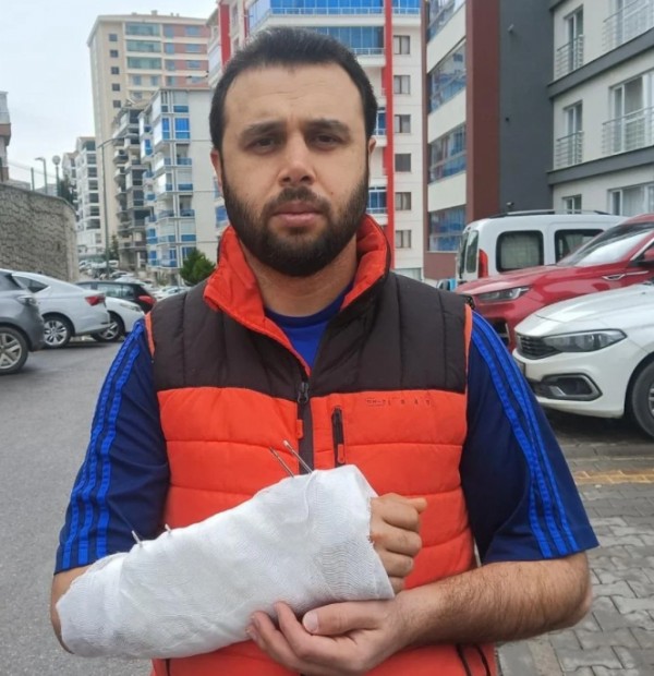 Sahipsiz Köpek Sorunu İşinden Etti!