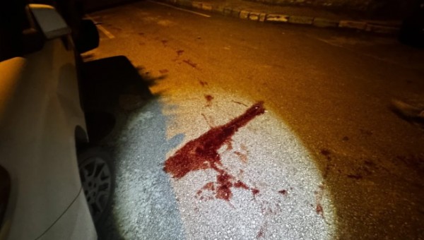 Arkadaşını Bıçakladı Kaçtı!