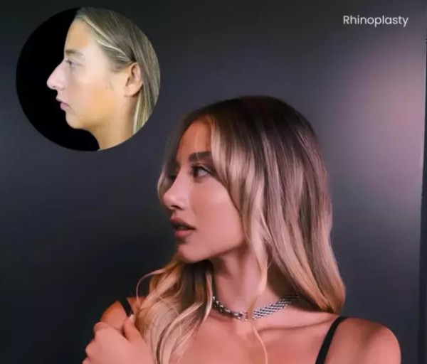 Aleyna Kalaycıoğlu'nun Başarılı Estetiği!