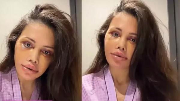 Didem Ceran Kansere Yakalandı