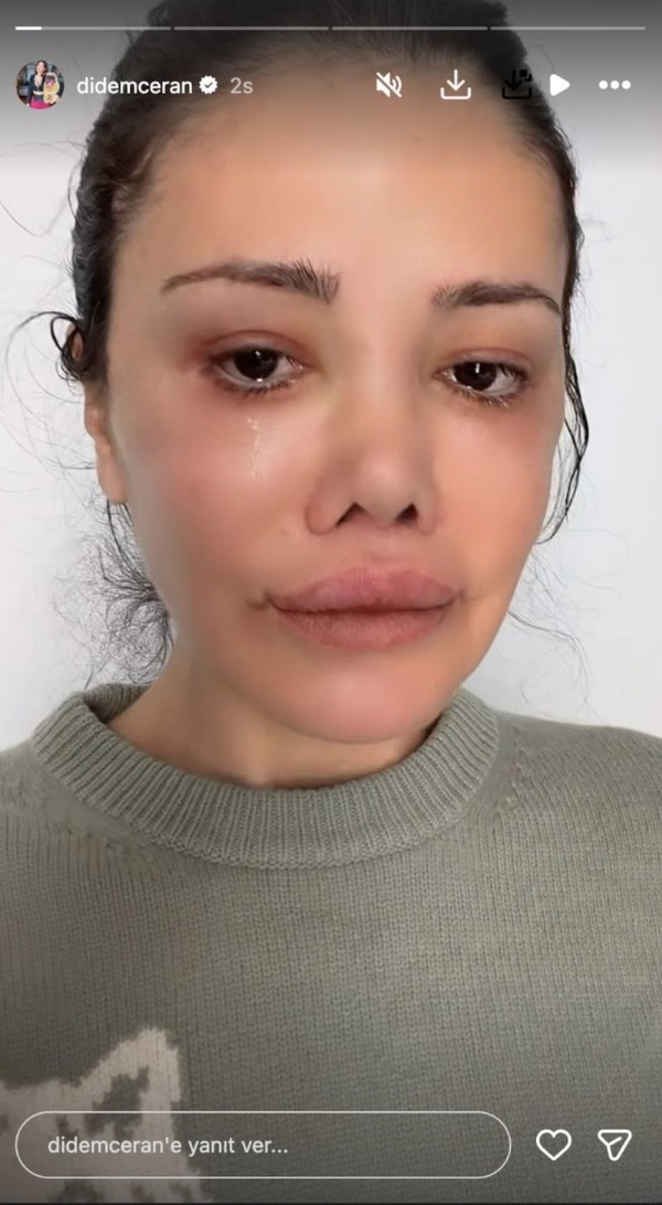 Didem Ceran Kansere Yakalandı