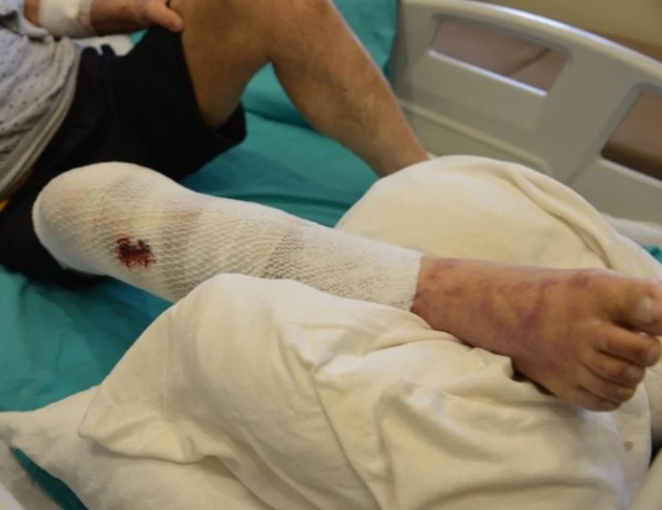 Ağrı'da lavabo giderini açmak isterken yandı