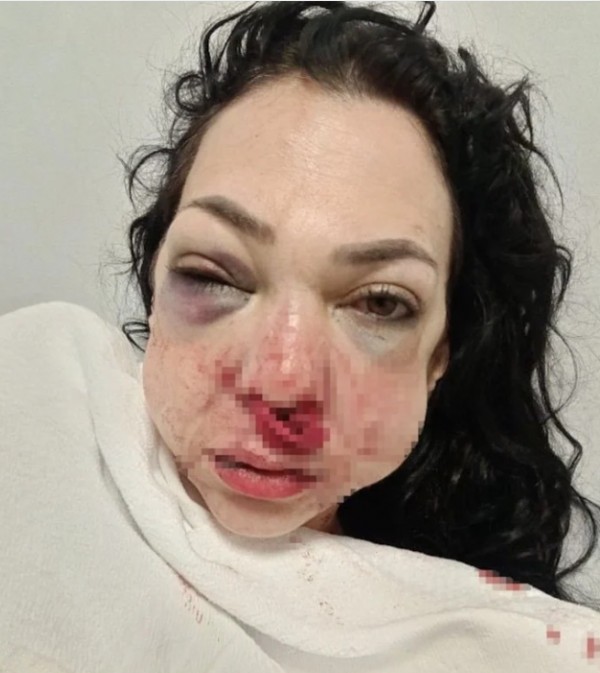 Kocaeli'de gittikleri kafede anne ve oğlu darbedildi